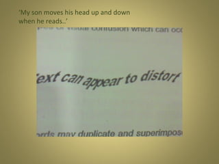 ‘My son moves his head up and down
when he reads..’

 