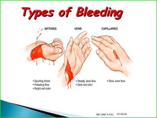 first aid talk | PPT