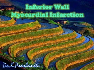 Inferior Wall  Myocardial Infarction Dr.K.Prashanthi 