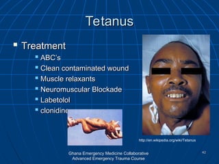 Comprehensive Guide to Environmental Injuries in Emergency Trauma Care ...