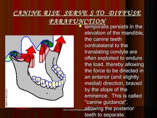 Development of muscles of mastication / dental implant courses