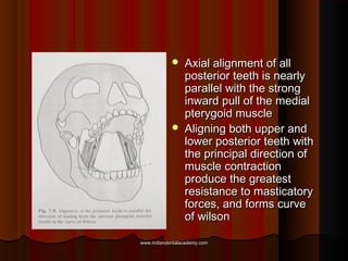  Axial alignment of allAxial alignment of all
posterior teeth is nearlyposterior teeth is nearly
parallel with the strong...
