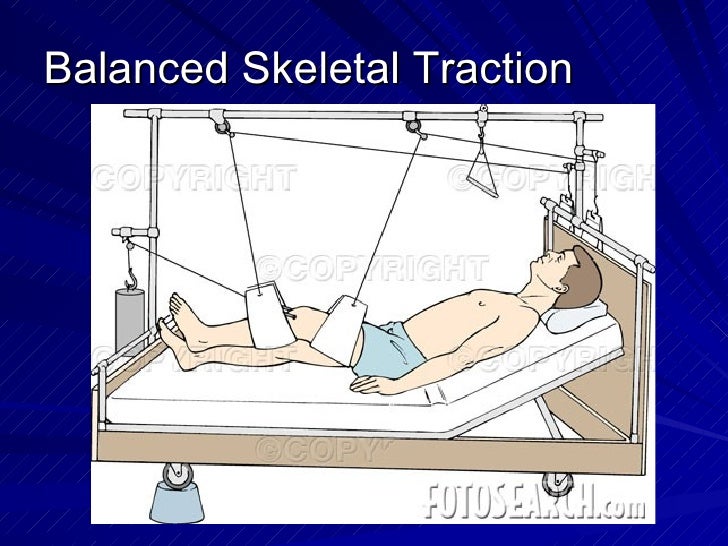 Musculoskeletal System