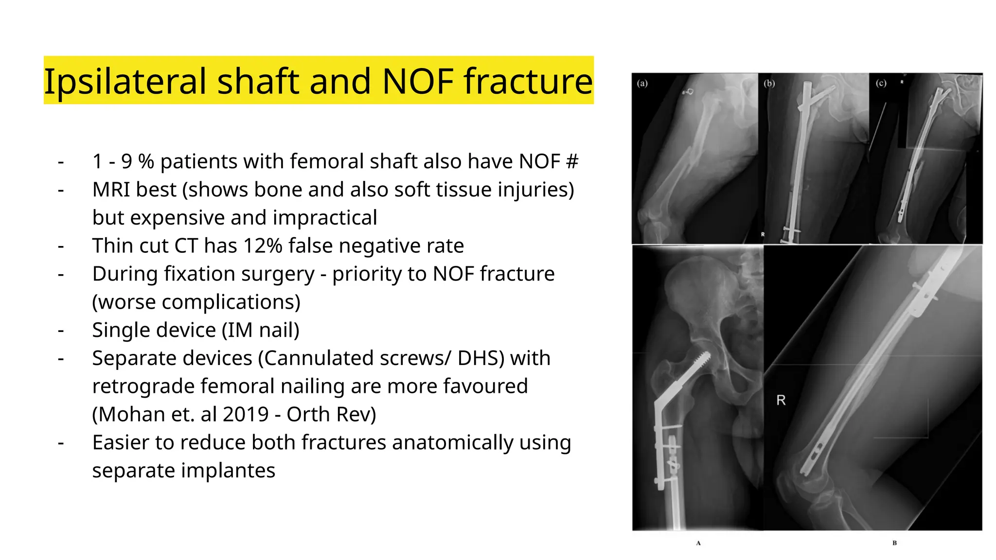 Neck Of Femur Fractures In Malaysia pptx Neck Of Femur Fractures In Malaysia pptx