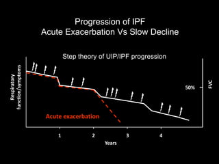 Uip Progression Time Course Diffuse Parenchymal Lung Diseases | PPTX