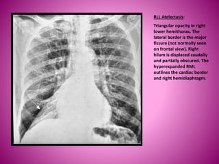 Copy of PP Bimbingan Koas TORAKS PATOLOGIS, OK.pptx