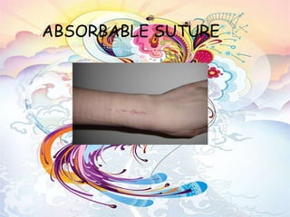   ABSORBABLE SUTURE 