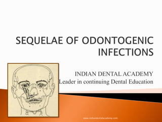 INDIAN DENTAL ACADEMY
Leader in continuing Dental Education
www.indiandentalacademy.com
 