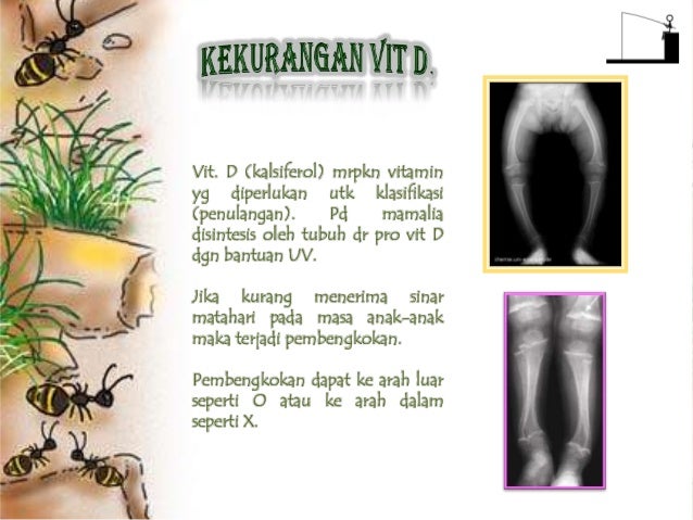 Copy Of Sistem Gerak Manusia