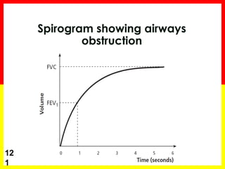 12 
1 
Spirogram showing airways 
obstruction 
 