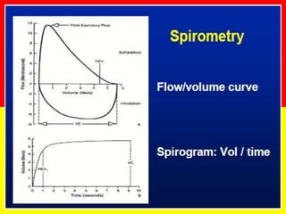 Volume-time spirogram 
 