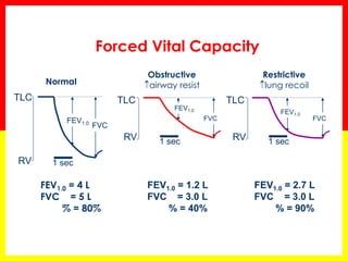 Forced Vital Capacity 
TLC 
FEV1.0 FVC 
1 sec 
FEV1.0 = 4 L 
FVC = 5 L 
% = 80% 
RV 
Normal 
TLC 
FEV1.0 
FVC 
1 sec 
FEV1.0 = 1.2 L 
FVC = 3.0 L 
% = 40% 
RV 
Obstructive 
airway resist 
Restrictive 
lung recoil 
TLC 
FEV1.0 
FVC 
1 sec 
FEV1.0 = 2.7 L 
FVC = 3.0 L 
% = 90% 
RV 
 