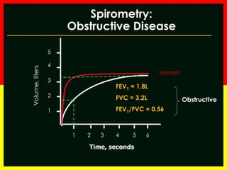 Spirometry: 
Obstructive Disease 
Volume, liters 
FEV1 = 1.8L 
FVC = 3.2L 
FEV1/FVC = 0.56 
Time, seconds 
5 
4 
3 
2 
1 
1 2 3 4 5 6 
Normal 
Obstructive 
 