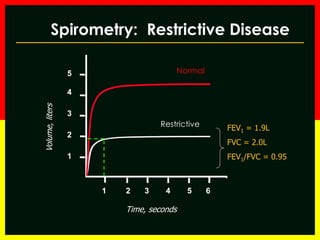 Spirometry: Restrictive Disease 
Volume, liters 
Time, seconds 
FEV1 = 1.9L 
FVC = 2.0L 
FEV1/FVC = 0.95 
1 2 3 4 5 6 
5 
4 
3 
2 
1 
Normal 
Restrictive 
 