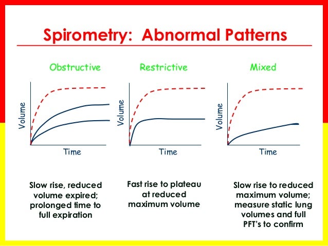 Normal Spirometry Chart