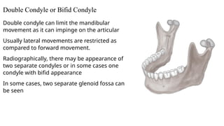 Condyle Pain Comprehensive Overview of Temporomandibular Joint Disorders: Etiology ...
