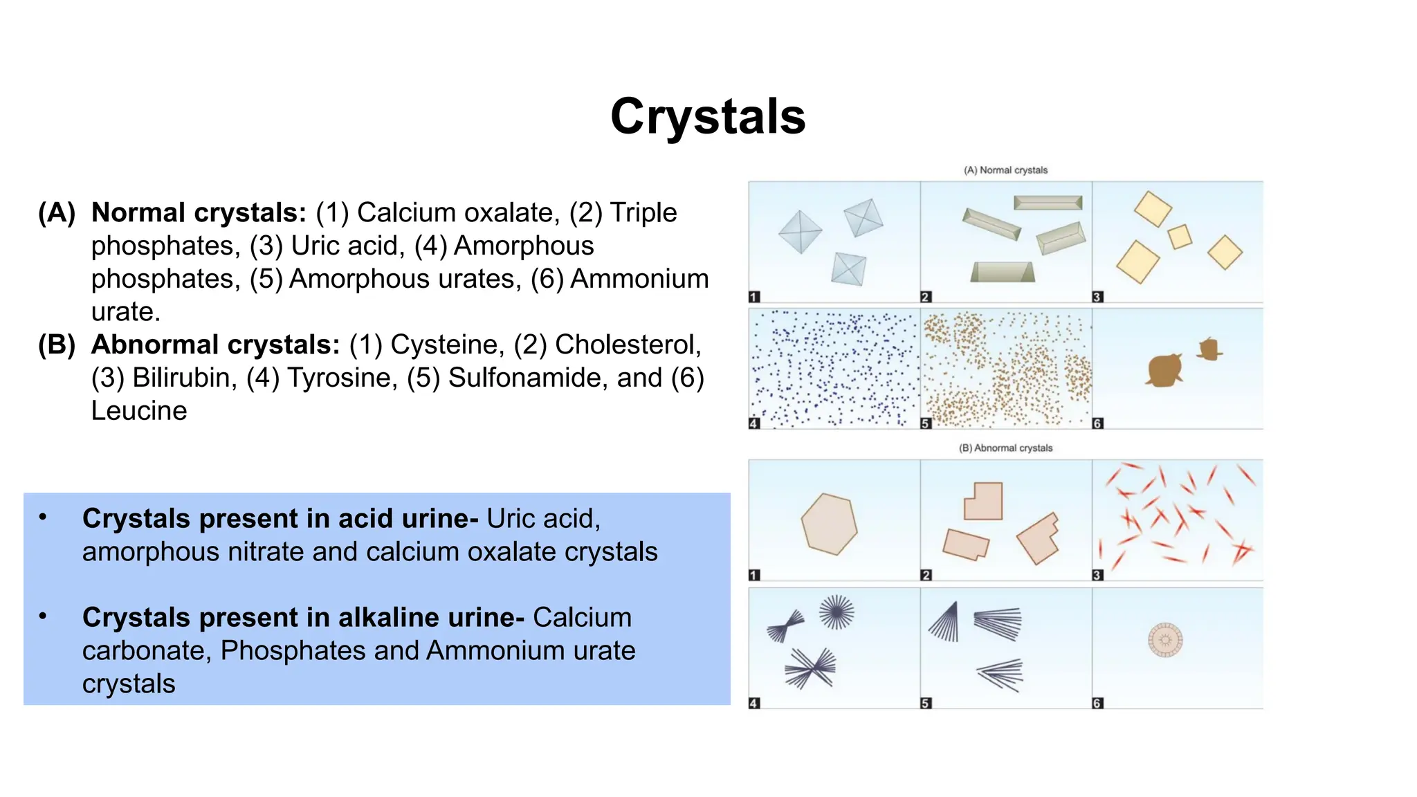 Crystals
(A) Normal crystals: (1) Calcium oxalate, (2) Triple
phosphates, (3) Uric acid, (4) Amorphous
phosphates, (5) Amorphous urates, (6) Ammonium
urate.
(B) Abnormal crystals: (1) Cysteine, (2) Cholesterol,
(3) Bilirubin, (4) Tyrosine, (5) Sulfonamide, and (6)
Leucine
• Crystals present in acid urine- Uric acid,
amorphous nitrate and calcium oxalate crystals
• Crystals present in alkaline urine- Calcium
carbonate, Phosphates and Ammonium urate
crystals
 