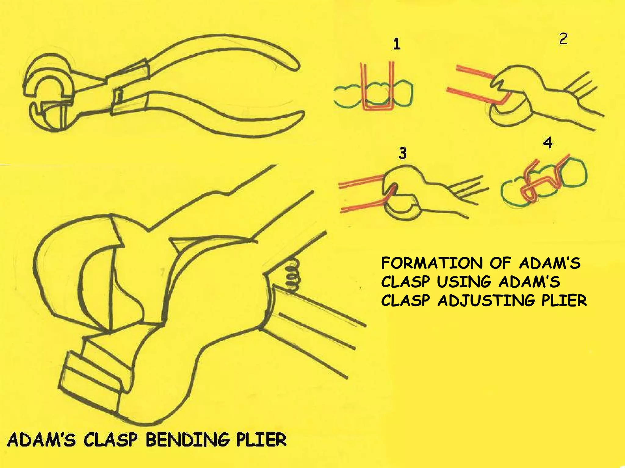 ADAM’S CLASP BENDING PLIER 1 2 3 4 FORMATION OF ADAM’S CLASP USING ADAM’S CLASP ADJUSTING PLIER 