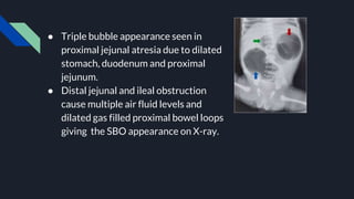 Approach to X ray Abdomen and KUB.pptx