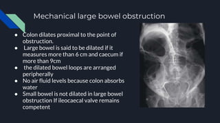 Approach to X ray Abdomen and KUB.pptx