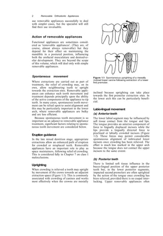 Copy removable orthodontic appliances | PDF