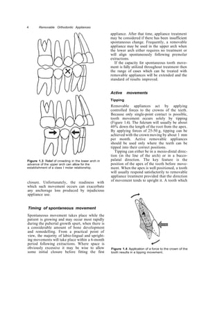 Copy removable orthodontic appliances | PDF