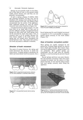 Copy removable orthodontic appliances | PDF