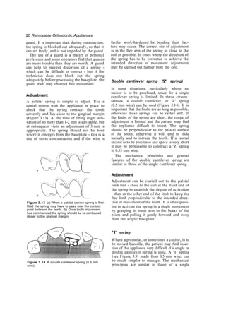 Copy removable orthodontic appliances | PDF