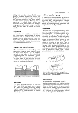 Copy removable orthodontic appliances | PDF