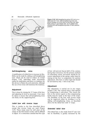 Copy removable orthodontic appliances | PDF