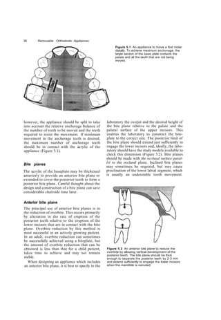 Copy removable orthodontic appliances | PDF