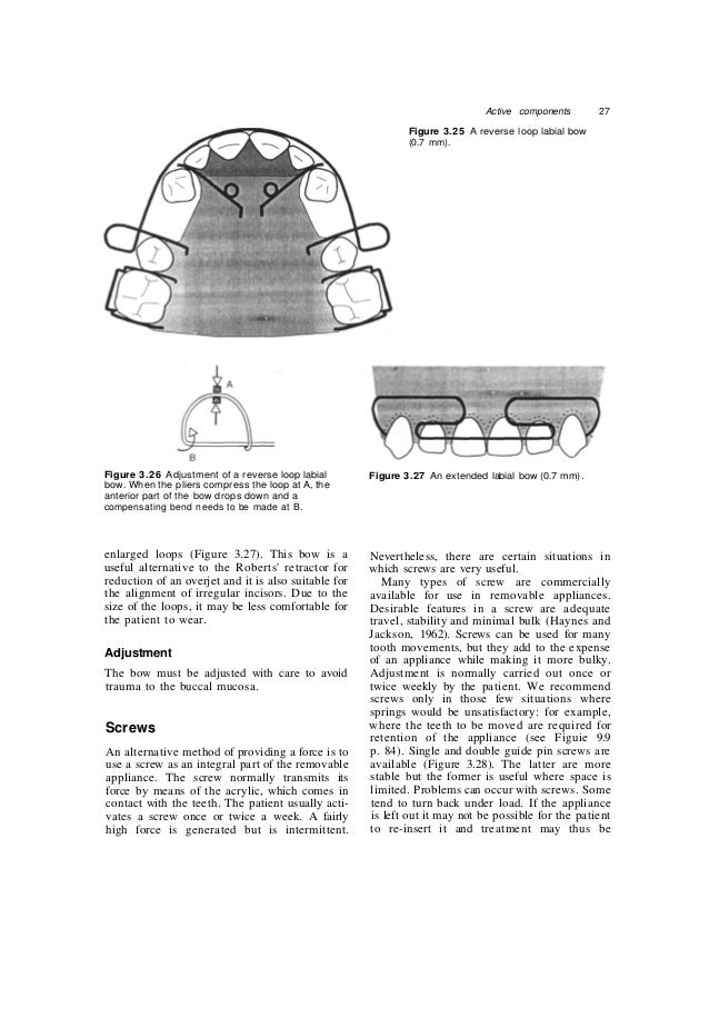 Copy removable orthodontic appliances