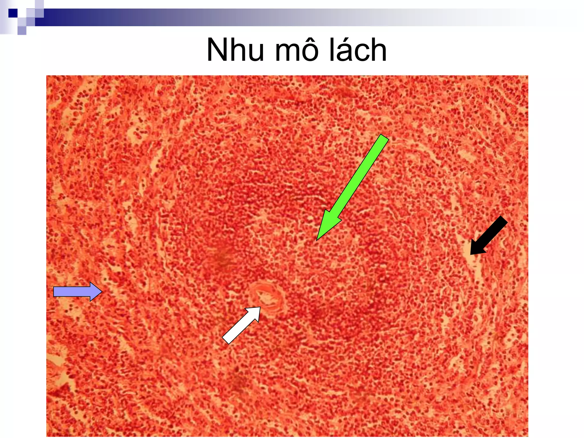 Co quan tao huyet va mien dichok | PPT
