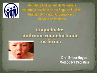 Dra: Erlina Hoyos
Médico R1 Pediatría
 