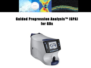 Guided Progression Analysis™ (GPA) for GDx 