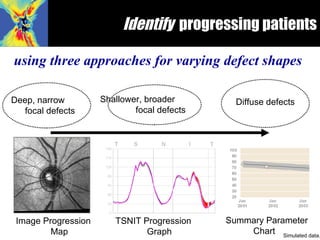 <ul><li>using three approaches for varying defect shapes </li></ul>Identify   progressing patients Diffuse defects TSNIT P...