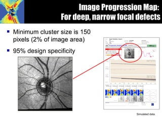<ul><li>Minimum cluster size is 150 pixels (2% of image area) </li></ul><ul><li>95% design specificity </li></ul>Simulated...