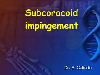 Subcoracoid impingement Dr. E. Galindo 