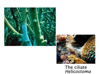 The ciliate
Helicostoma
 