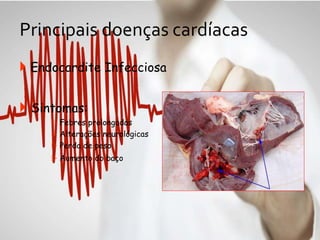 Principais doenças cardíacas
 Endocardite Infecciosa
 Sintomas:
 Febres prolongadas
 Alterações neurológicas
 Perda de peso
 Aumento do baço
 