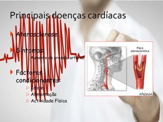 Principais doenças cardíacas
 Aterosclerose
 Sintomas:
 Aumento da pressão arterial
 Factores
condicionantes:
 Idade
 Alimentação
 Actividade Física
 