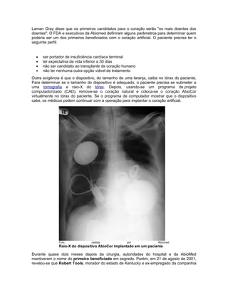 Laman Gray disse que os primeiros candidatos para o coração serão "os mais doentes dos
doentes". O FDA e executivos da Abiomed definiram alguns parâmetros para determinar quem
poderia ser um dos primeiros beneficiados com o coração artificial. O paciente precisa ter o
seguinte perfil:


  •   ser portador de insuficiência cardíaca terminal
  •   ter expectativa de vida inferior a 30 dias
  •   não ser candidato ao transplante de coração humano
  •   não ter nenhuma outra opção viável de tratamento
Outra exigência é que o dispositivo, do tamanho de uma laranja, caiba no tórax do paciente.
Para determinar se o tamanho do dispositivo é adequado, o paciente precisa se submeter a
uma tomografia e raio-X do tórax. Depois, usando-se um programa de projeto
computadorizado (CAD), remove-se o coração natural e coloca-se o coração AbioCor
virtualmente no tórax do paciente. Se o programa de computador mostrar que o dispositivo
cabe, os médicos podem continuar com a operação para implantar o coração artificial.




               Foto              cedida              por              Abiomed
               Raio-X do dispositivo AbioCor implantado em um paciente

Durante quase dois meses depois da cirurgia, autoridades do hospital e da AbioMed
mantiveram o nome do primeiro beneficiado em segredo. Porém, em 21 de agosto de 2001,
revelou-se que Robert Tools, morador do estado de Kentucky e ex-empregado da companhia
 