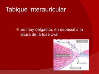 Tabique interauricular
 Es muy delgadito, en especial a la
altura de la fosa oval.
 