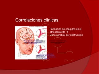 Correlaciones clínicas
Valvulopatía
Estenosis: Incapacidad de la
válvula para abrirse por
completo.
Tx: Valvuloplastía  Se
remplazan las válvulas
dañadas. Pueden ser
artificiales o de cerdo.
Regurgitación: Incapacidad
de la válvula para cerrarse
por completo.
Pueden ser congénitas o
adquiridas. Ambas causan
una sobrecarga sanguínea en
el corazón.
Formación de coágulos en el
atrio izquierdo 
Daño cerebral por obstrucción
 