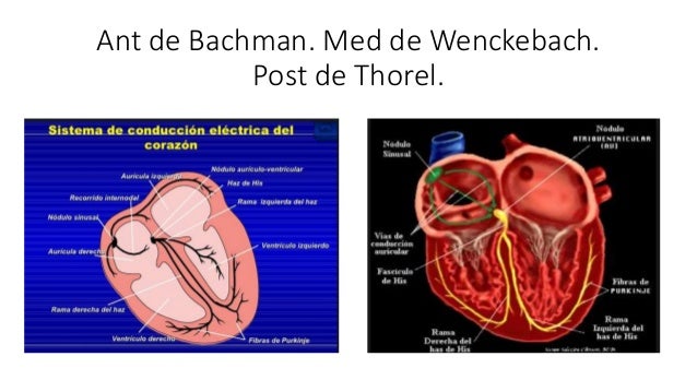 Haz De Bachman Wenckebach Y Thorel