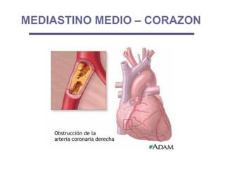 MEDIASTINO MEDIO – CORAZON
 