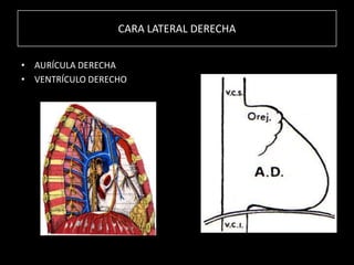 CARA LATERAL DERECHA
• AURÍCULA DERECHA
• VENTRÍCULO DERECHO

 