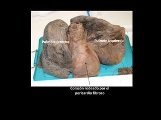 Pulmón derecho

Pulmón izquierdo

Corazón rodeado por el
pericardio fibroso

 