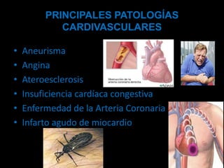 PRINCIPALES PATOLOGÍAS
CARDIVASCULARES
•
•
•
•
•
•

Aneurisma
Angina
Ateroesclerosis
Insuficiencia cardíaca congestiva
Enfermedad de la Arteria Coronaria
Infarto agudo de miocardio

 