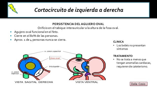 Corazón- Patología especial
